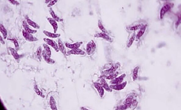 Parasit protozoa Toxoplasma gondii agen penyebab toksoplasmosis