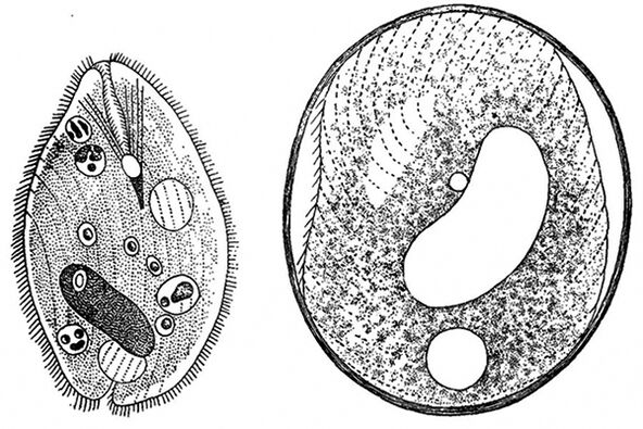 Parasit protozoa dari Balantidia